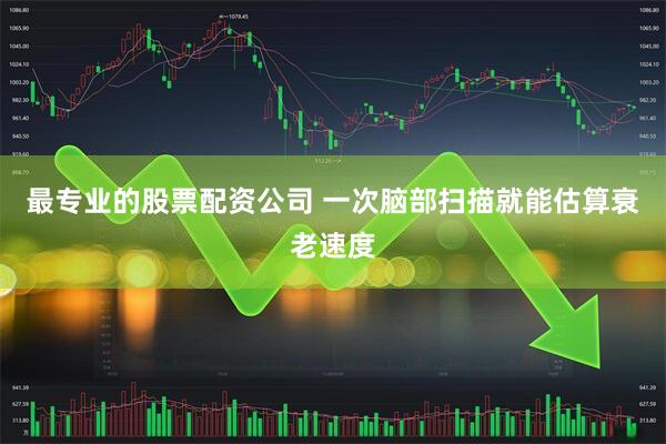 最专业的股票配资公司 一次脑部扫描就能估算衰老速度
